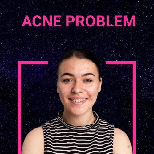 ACNE PROBLEM.jpg